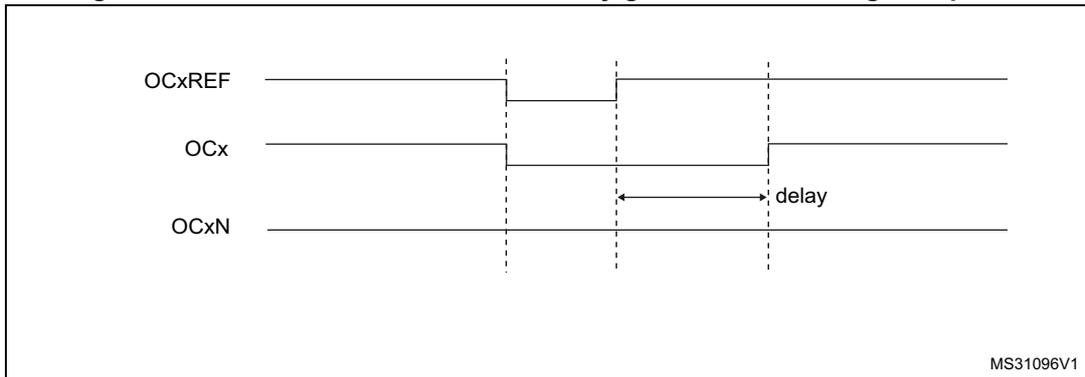 Timing diagram for Figure 87 showing dead-time waveforms with delay greater than the negative pulse. The diagram shows three signals: OCxREF, OCx, and OCxN. OCxREF is a periodic signal. OCx is the output signal, which is the complement of OCxREF with a delay. OCxN is the complementary output signal, which is the complement of OCx. The delay is indicated by a horizontal arrow between the falling edge of OCxREF and the falling edge of OCxN. The diagram is labeled MS31096V1.