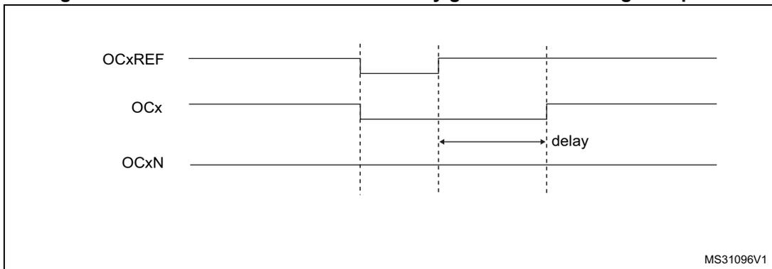 Timing diagram showing dead-time waveforms where the delay is greater than the negative pulse. It includes waveforms OCxREF, OCx, and OCxN with a 'delay' label indicating the dead-time interval. The diagram is labeled MS31096V1.