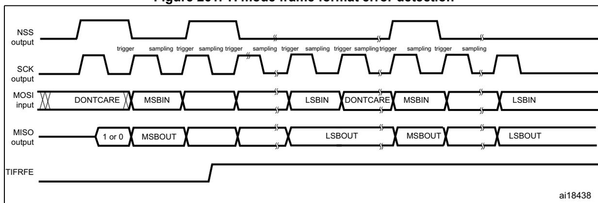 Timing diagram for TI mode frame format error detection. It shows four waveforms: NSS output, SCK output, MOSI input, and MISO output. The NSS output shows a pulse during an ongoing transfer. The SCK output is a periodic clock. The MOSI input shows data segments labeled DONT CARE, MSBIN, and LSBIN. The MISO output shows data segments labeled 1 or 0, MSBOUT, and LSBOUT. The TIFRFE flag is shown going high when the NSS pulse occurs. The diagram is labeled ai18438.