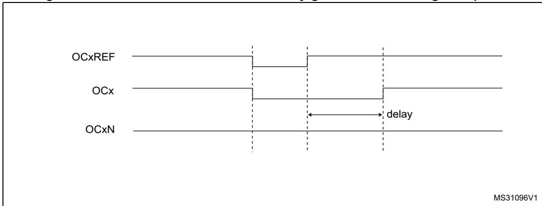 Timing diagram for Figure 98 showing OCxREF, OCx, and OCxN waveforms where the dead-time delay is greater than the negative pulse width. The diagram shows three horizontal lines representing the signals. OCxREF is a reference signal. OCx and OCxN are complementary output signals. A 'delay' label indicates the dead-time interval.