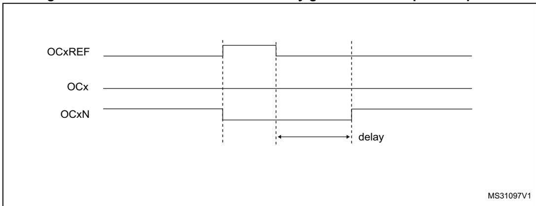 Timing diagram for Figure 99 showing OCxREF, OCx, and OCxN waveforms where the dead-time delay is greater than the positive pulse width. The diagram shows three horizontal lines representing the signals. OCxREF is a reference signal. OCx and OCxN are complementary output signals. A 'delay' label indicates the dead-time interval.