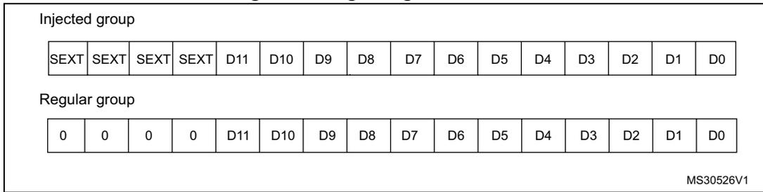 Diagram showing right alignment of data for injected and regular groups. Injected group: SEXT, SEXT, SEXT, SEXT, D11, D10, D9, D8, D7, D6, D5, D4, D3, D2, D1, D0. Regular group: 0, 0, 0, 0, D11, D10, D9, D8, D7, D6, D5, D4, D3, D2, D1, D0. MS30526V1