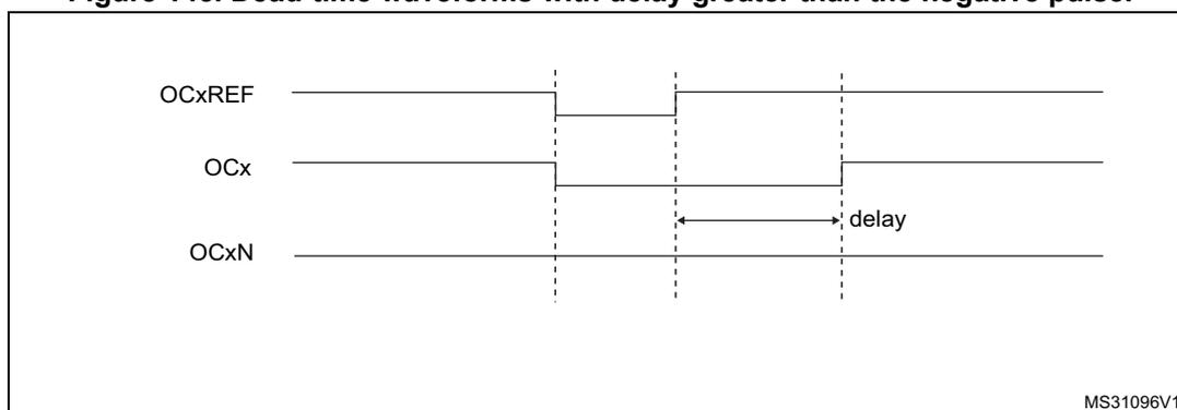 Timing diagram for Figure 145 showing dead-time waveforms with delay greater than the negative pulse. The diagram shows three signals: OCxREF, OCx, and OCxN. OCxREF is a periodic signal. OCx is a signal that is high when OCxREF is high and low otherwise. OCxN is a signal that is low when OCxREF is high and high otherwise. A 'delay' is indicated between the falling edge of OCxREF and the falling edge of OCxN.