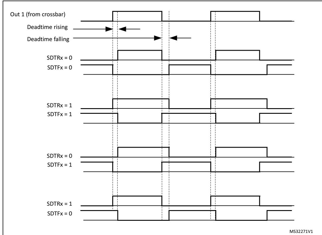 Timing diagram showing deadtime insertion for different SDTRx and SDTFx bit configurations.
