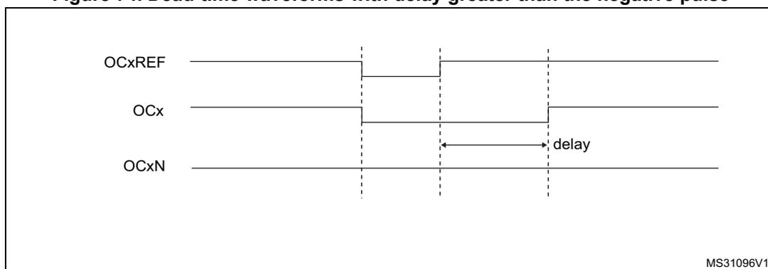 Timing diagram for dead-time waveforms with delay greater than the negative pulse. It shows three waveforms: OCxREF, OCx, and OCxN. OCxREF is a reference signal. OCx and OCxN are complementary outputs. Dead-time is indicated by a 'delay' label between the transitions of OCx and OCxN. The diagram is labeled MS31096V1.