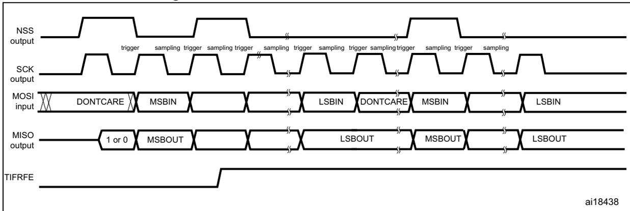 Timing diagram for TI mode frame format error detection showing NSS, SCK, MOSI, MISO, and TIFRFE signals over time. The diagram shows two frames. In the first frame, MOSI has DONT CARE, MSBIN, and LSBIN segments. In the second frame, MOSI has DONT CARE, MSBIN, and LSBIN segments. MISO has 1 or 0, MSBOUT, and LSBOUT segments. TIFRFE is shown as a signal that goes high after the first frame.