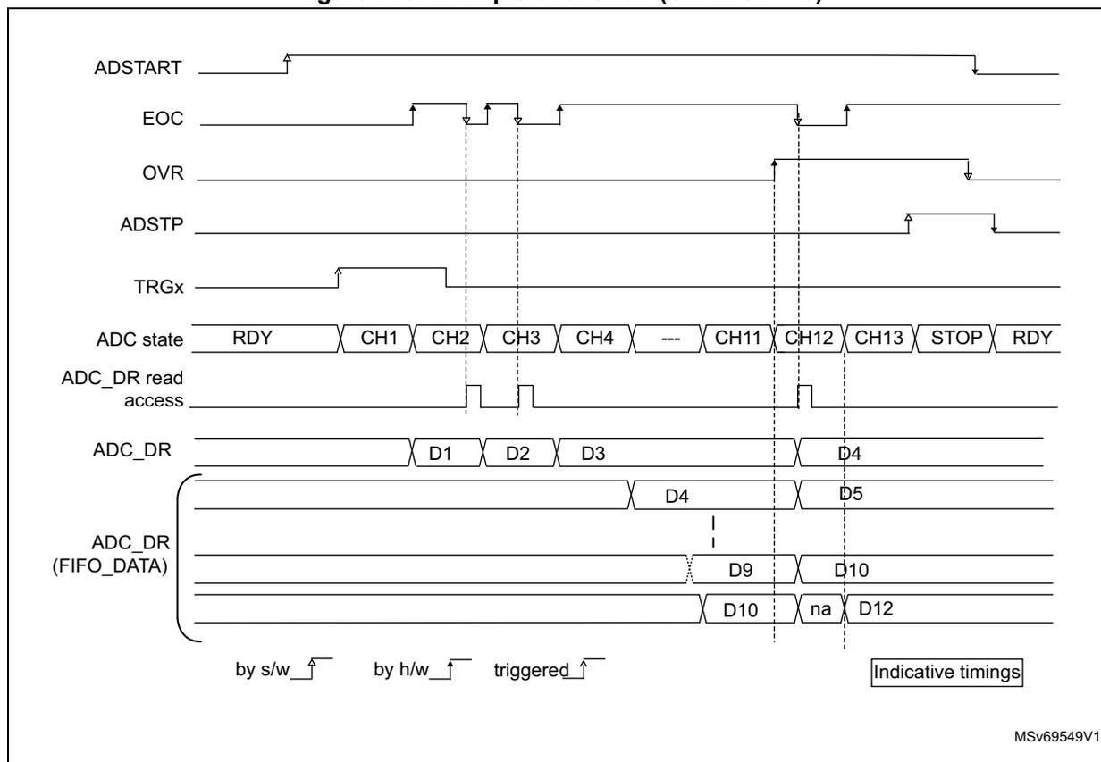 Timing diagram for Figure 175 showing an overrun condition when OVRMOD = 0. The diagram illustrates the relationship between ADSTART, EOC, OVR, ADSTP, TRGx, ADC state, ADC_DR read access, ADC_DR, and ADC_DR (FIFO_DATA) signals. It shows that when a new conversion starts before the previous one is read, the OVR flag is set and the data is lost in the FIFO.