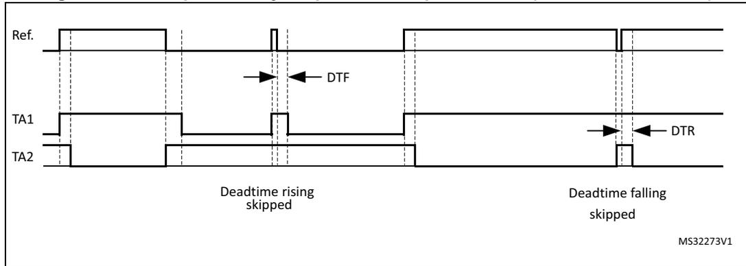 Timing diagram for Figure 339 showing complementary outputs for low pulse width with SDTRx = SDTFx = 1. The diagram shows three waveforms: Ref., TA1, and TA2. The Ref. waveform has two pulses. The TA1 and TA2 waveforms are complementary outputs. The deadtime rising and falling are skipped. The diagram is labeled MS32273V1.