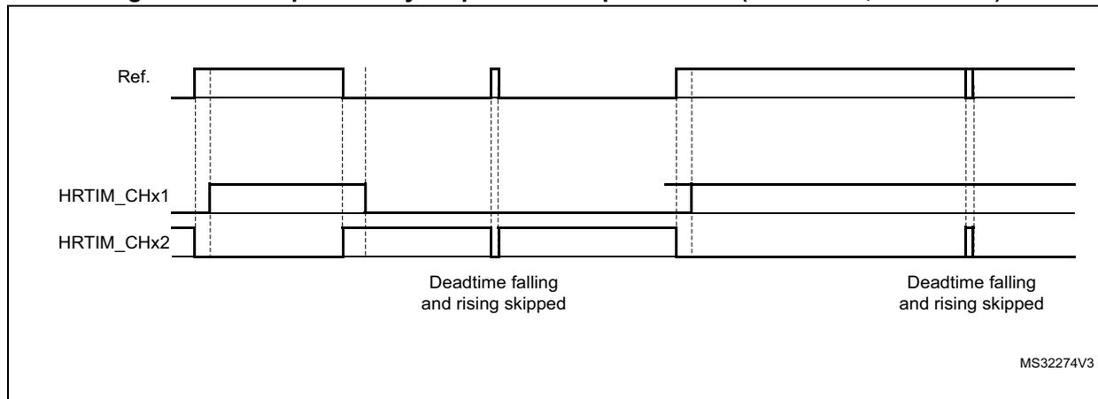 Timing diagram for Figure 340 showing complementary outputs for low pulse width with SDTRx = 0, SDTFx = 1. The diagram shows three waveforms: Ref., HRTIM_CHx1, and HRTIM_CHx2. The Ref. waveform has two pulses. The HRTIM_CHx1 and HRTIM_CHx2 waveforms are complementary outputs. The deadtime falling and rising are skipped. The diagram is labeled MS32274V3.
