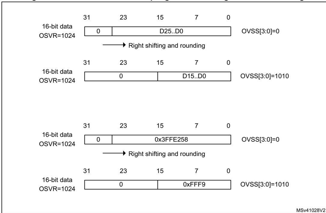 Diagram showing four examples of 16-bit data processing with oversampling and right shifting. Each example shows a 32-bit register layout with bit positions 31, 23, 15, 7, and 0. The first example shows raw data D25..D0 with OVSS[3:0]=0. The second example shows data after right shifting and rounding with OVSS[3:0]=1010, resulting in D15..D0. The third example shows raw data 0x3FFFE258 with OVSS[3:0]=0. The fourth example shows data after right shifting and rounding with OVSS[3:0]=1010, resulting in 0xFFF9. Arrows indicate the 'Right shifting and rounding' process between the first and second, and third and fourth examples. MSv41028V2 is noted at the bottom right.