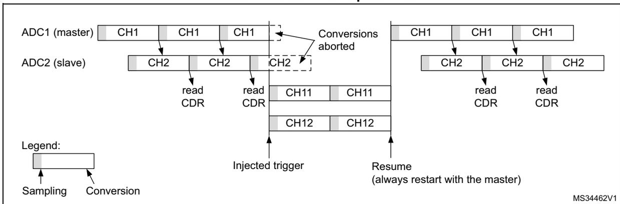 Timing diagram for Figure 149 (case 1) showing two interleaved channels (CH1, CH2) with an injected sequence (CH11, CH12) where the master is interrupted first. It shows ADC1 (master) and ADC2 (slave) sequences. The master's conversion of CH1 is interrupted by the injected sequence. The slave's conversion of CH2 completes. After the injected sequence, the master resumes its conversion. A legend indicates Sampling and Conversion phases.
