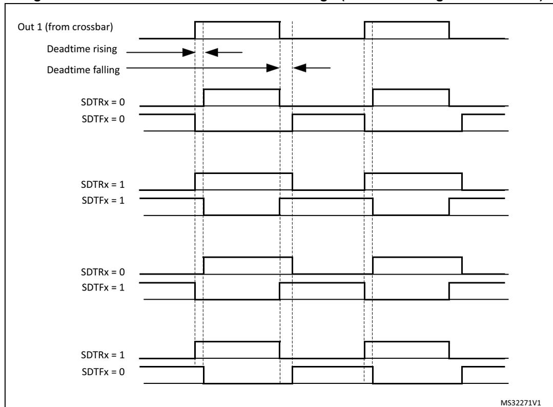Timing diagram showing Out 1 (from crossbar) and SDTRx/SDTFx signal waveforms for different deadtime settings. The diagram illustrates four cases: 1) SDTRx=0, SDTFx=0 (no deadtime); 2) SDTRx=1, SDTFx=1 (negative deadtime); 3) SDTRx=0, SDTFx=1 (negative deadtime); 4) SDTRx=1, SDTFx=0 (positive deadtime). Arrows indicate the deadtime rising and falling intervals.