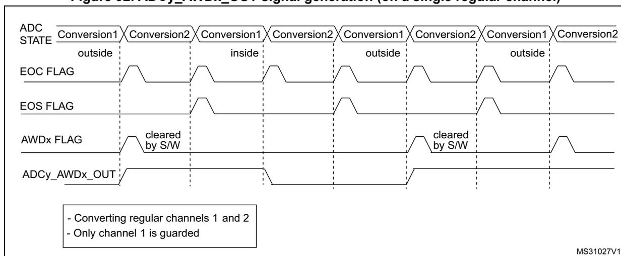 Timing diagram for Figure 92 showing ADC STATE, EOC FLAG, EOS FLAG, AWDx FLAG, and ADCy_AWDx_OUT signals for regular channels 1 and 2, where only channel 1 is guarded. The AWDx FLAG is set by Conversion1 (outside) and cleared by software. The ADCy_AWDx_OUT signal goes high when Conversion1 is 'outside' and low when it is 'inside'.