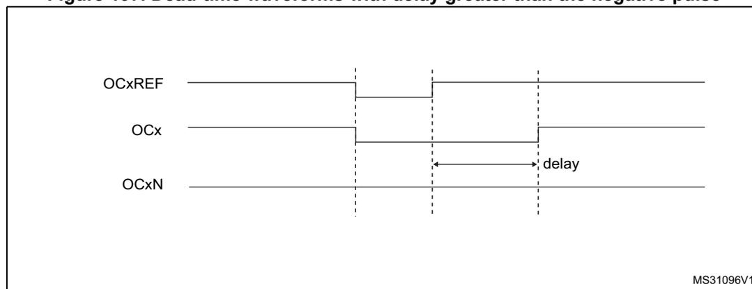Timing diagram for Figure 197 showing OCxREF, OCx, and OCxN waveforms where the delay is greater than the negative pulse width.