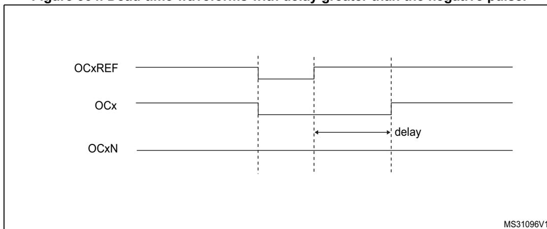 Timing diagram for Figure 364 showing dead-time waveforms with delay greater than the negative pulse.