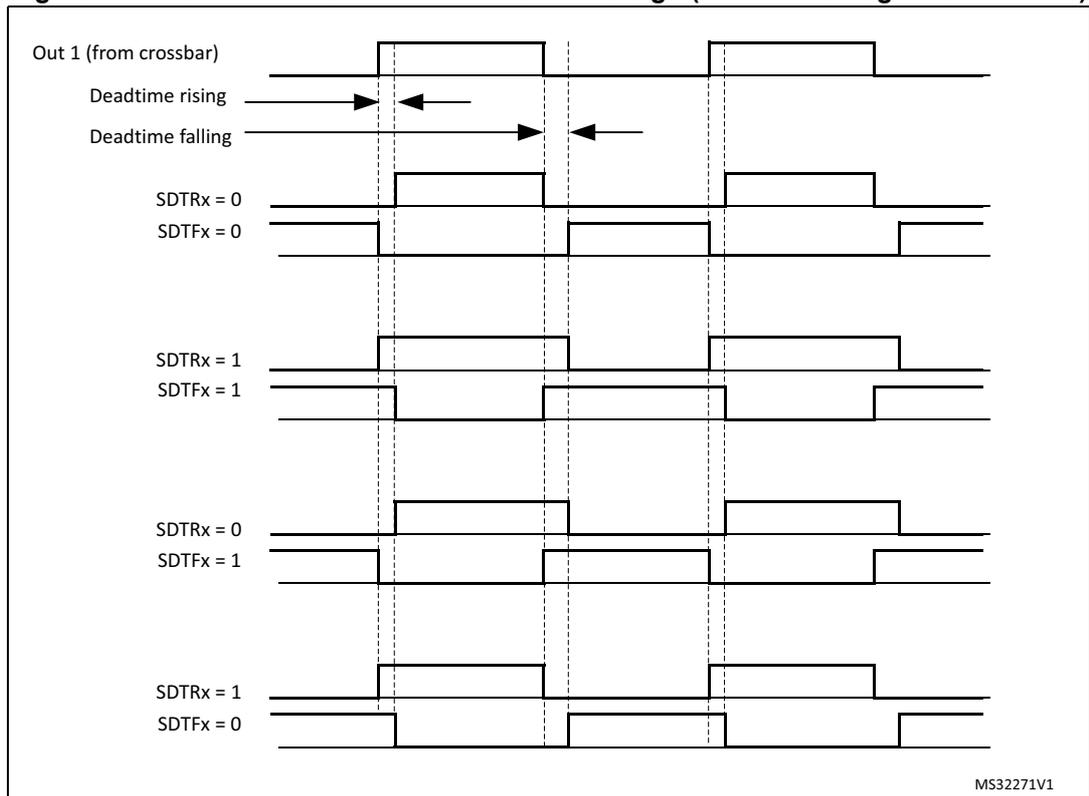 Timing diagram showing deadtime insertion versus deadtime sign. The diagram includes five waveforms: Out 1 (from crossbar), Deadtime rising (indicated by a right arrow), Deadtime falling (indicated by a left arrow), and four pairs of complementary square waves (HRTIM_CHx1 and HRTIM_CHx2) corresponding to different deadtime sign settings: SDTRx = 0, SDTFx = 0; SDTRx = 1, SDTFx = 1; SDTRx = 0, SDTFx = 1; and SDTRx = 1, SDTFx = 0. The deadtime is shown as the time interval between the falling edge of one output and the rising edge of the other.