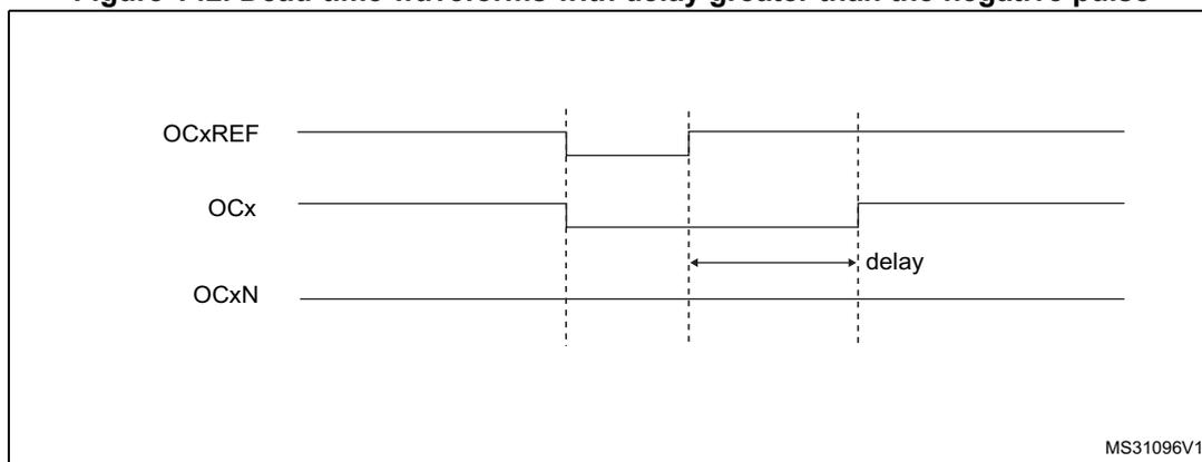 Timing diagram for Figure 142 showing dead-time waveforms with a delay greater than the negative pulse. The diagram displays three waveforms: OCxREF (reference), OCx (output), and OCxN (complementary output). OCxREF is a square wave. OCx is the same as OCxREF but with a delayed rising edge. OCxN is a constant high signal because the delay is greater than the width of the negative pulse of OCxREF. The delay is indicated by an arrow and the word 'delay'. The diagram is labeled MS31096V1.
