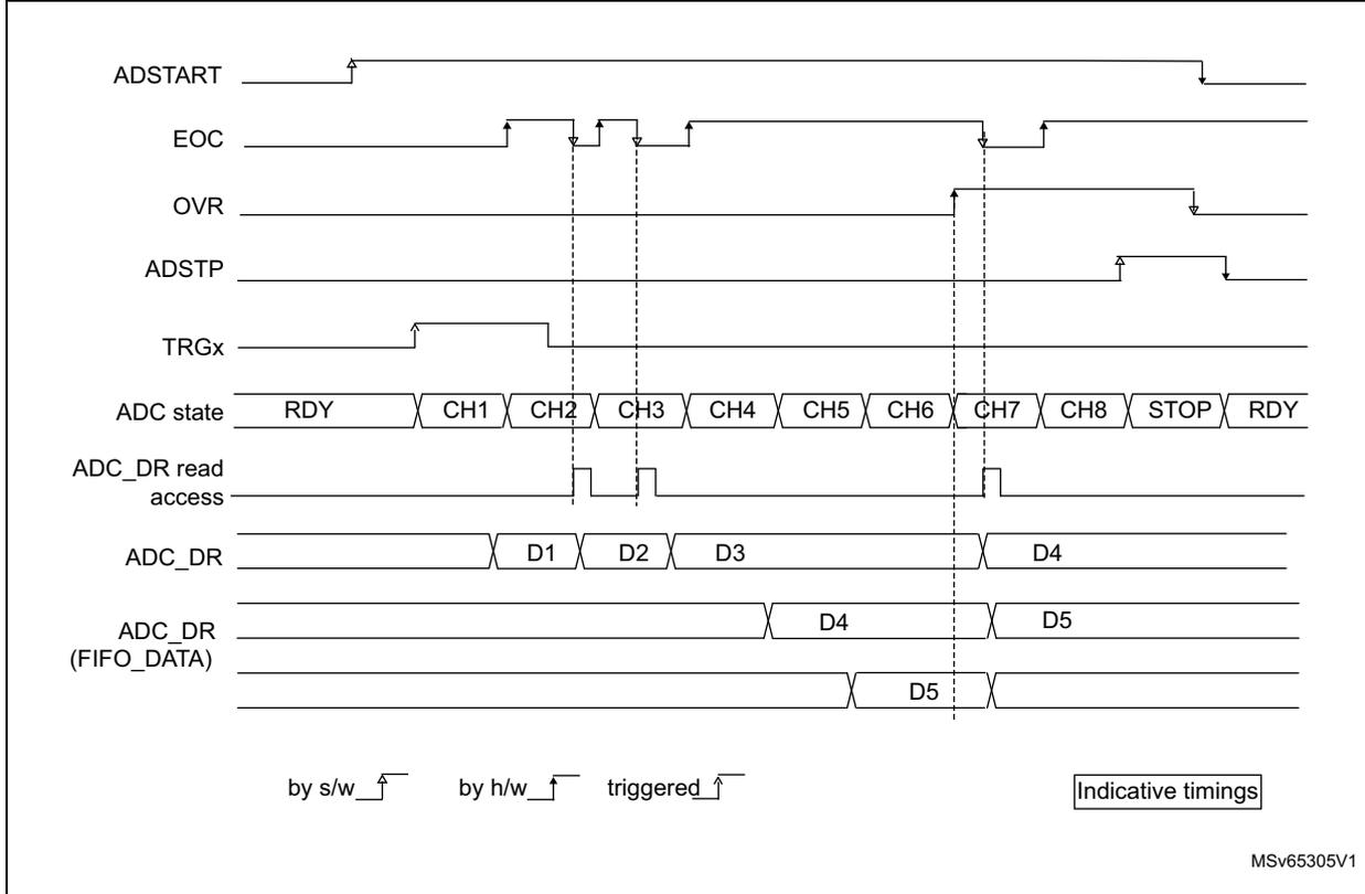 Timing diagram showing an overrun condition in ADC3. It displays signals ADSTART, EOC, OVR, ADSTP, TRGx, ADC state, ADC_DR, and ADC_DR (FIFO_DATA) over time. The diagram shows that when a new conversion starts before the previous one is read, the OVR flag is set and the previous data is lost in the DR register but remains in the FIFO.