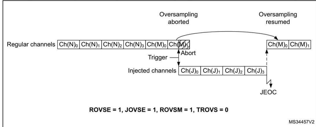Timing diagram for Figure 278 showing regular and injected oversampling modes. Regular channels: Ch(N)0, Ch(N)1, Ch(N)2, Ch(N)3, Ch(M)0, Ch(M)1. Injected channels: Ch(J)0, Ch(J)1, Ch(J)2, Ch(J)3. A trigger starts the sequence. An 'Abort' occurs after Ch(N)3. Oversampling is aborted and then resumed for the regular channels. The diagram shows Ch(M)0 and Ch(M)1 being sampled again. JEOC (Injected End of Conversion) is marked at the end of the injected channels. Configuration: ROVSE = 1, JOVSE = 1, ROVSM = 1, TROVS = 0.