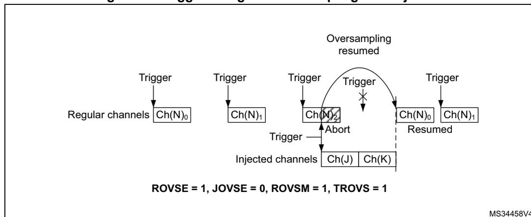 Figure 79: Triggered regular oversampling with injection. The diagram shows regular channels (Ch(N)0, Ch(N)1, Ch(N)2) and injected channels (Ch(J), Ch(K)). Each regular channel is triggered individually. When an injected channel is triggered, the regular oversampling is aborted. After the injected channels, the regular oversampling resumes. The configuration bits are ROVSE = 1, JOVSE = 0, ROVSM = 1, TROVS = 1.