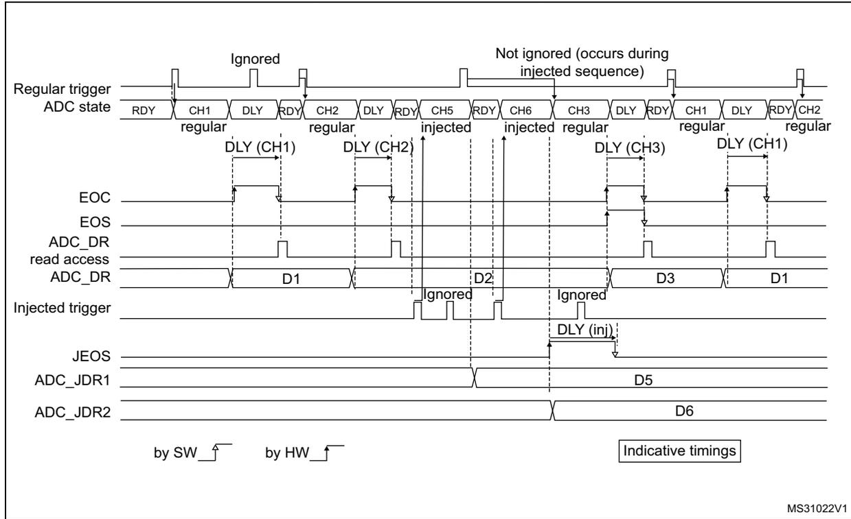 Timing diagram showing regular and injected ADC conversions with delays and triggers. The diagram illustrates the sequence of events for regular conversions (CH1, CH2, CH3) and injected conversions (CH5, CH6) when DISCEN and JDISCEN are enabled. It shows how injected conversions interrupt regular ones and how delays (DLY) are applied. Triggers are labeled as 'by SW' (software) or 'by HW' (hardware).