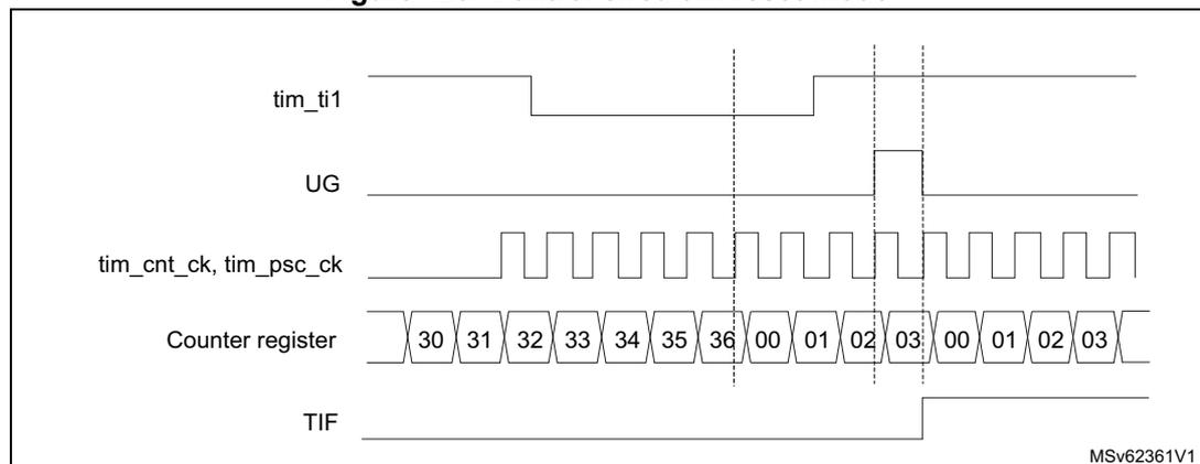 Timing diagram for Figure 429. Control circuit in reset mode. The diagram shows five horizontal lines representing different signals over time. 1. tim_ti1: An input signal that is initially high, then goes low, and then has a rising edge. 2. UG: A signal that pulses high when tim_ti1 has a rising edge. 3. tim_cnt_ck, tim_psc_ck: A periodic clock signal. 4. Counter register: A sequence of values starting at 30, increasing by 1 each clock cycle (31, 32, 33, 34, 35, 36), then resetting to 00, 01, 02, 03, and repeating. The reset occurs after the rising edge of tim_ti1. 5. TIF: A flag that goes high when the counter resets (at the rising edge of tim_ti1) and returns low after a short delay. Vertical dashed lines indicate the timing relationship between the rising edge of tim_ti1, the UG pulse, the counter reset, and the TIF flag assertion. The identifier MSv62361V1 is in the bottom right corner.