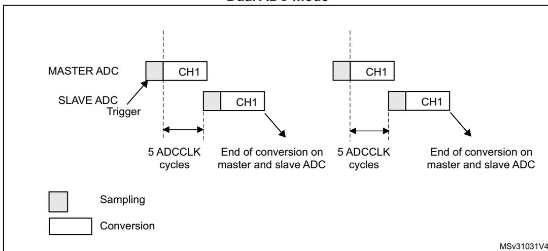 Timing diagram for Figure 302: Interleaved mode on 1 channel in single conversion mode. The diagram shows two horizontal timelines for MASTER ADC and SLAVE ADC. The MASTER ADC starts with a sampling phase (grey) followed by a conversion phase (white) labeled CH1. The SLAVE ADC is triggered by the MASTER ADC's sampling phase. The SLAVE ADC also has a sampling phase followed by a conversion phase labeled CH1. The time between the start of the MASTER ADC's sampling phase and the start of the SLAVE ADC's conversion phase is 5 ADCCLK cycles. The time between the start of the SLAVE ADC's conversion phase and the end of the MASTER ADC's conversion phase is also 5 ADCCLK cycles. The end of the conversion on both the master and slave ADC is marked. A legend indicates that grey boxes represent Sampling and white boxes represent Conversion. The diagram is labeled MSv31031V4.