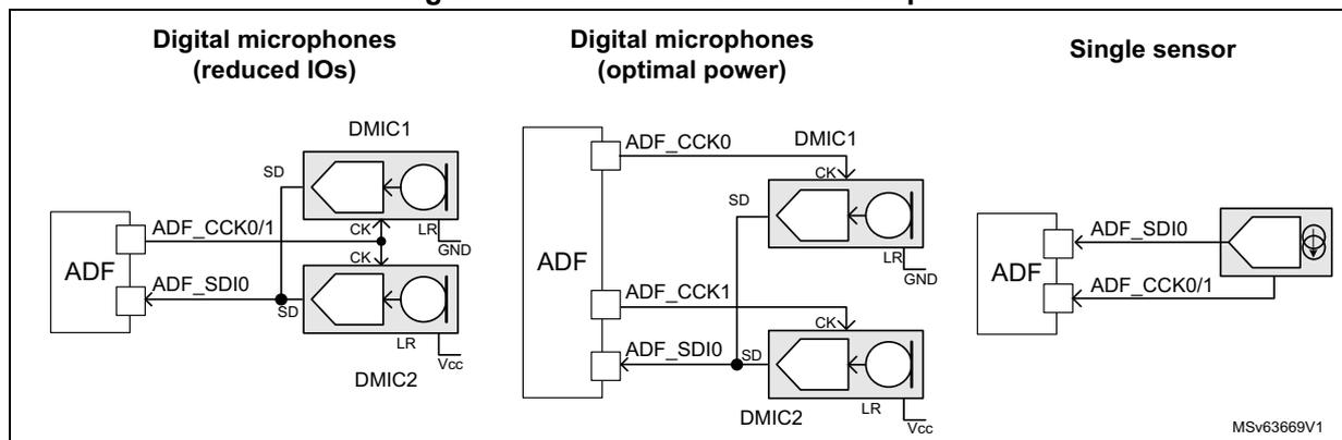 Figure 380: Sensor connection examples. The diagram shows three connection scenarios for digital microphones to an Audio Digital Filter (ADF). 1. Digital microphones (reduced IOs): Two microphones, DMIC1 and DMIC2, share clock and data lines. DMIC1 has LR connected to GND, DMIC2 has LR connected to Vcc. 2. Digital microphones (optimal power): Two microphones, DMIC1 and DMIC2, have separate clock lines (ADF_CCK0 and ADF_CCK1) but share a data line (ADF_SDIO). 3. Single sensor: A single sensor connected to ADF_SDIO and ADF_CCK0/1. Reference code MSV63669V1 is in the bottom right.