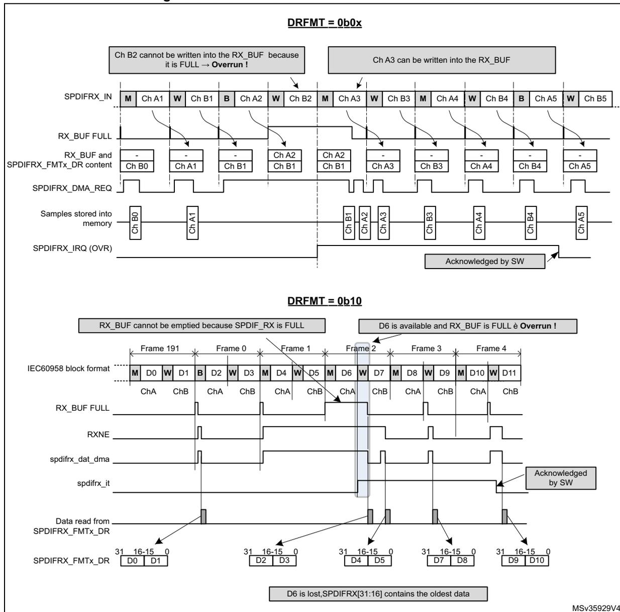 Timing diagrams for SPDIFRX overrun errors. The top diagram shows DRFMT = 0b0x with channels A1, B1, A2, B2, A3, B3, A4, B4, A5, B5. It highlights that Ch B2 cannot be written because RX_BUF is FULL (Overrun), while Ch A3 can be written. The bottom diagram shows DRFMT = 0b10 in IEC60958 block format with frames 191, 0, 1, 2, 3, 4. It shows that when RX_BUF is FULL, D6 is lost and SPDIFRX[31:16] contains the oldest data. Both diagrams show signals for SPDIFRX_IN, RX_BUF FULL, SPDIFRX_DMA_REQ, Samples stored into memory, and SPDIFRX_IRQ (OVR) being acknowledged by software.