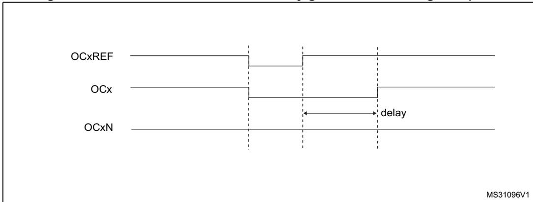 Timing diagram for Figure 98 showing OCxREF, OCx, and OCxN waveforms where the dead-time delay is greater than the negative pulse width.