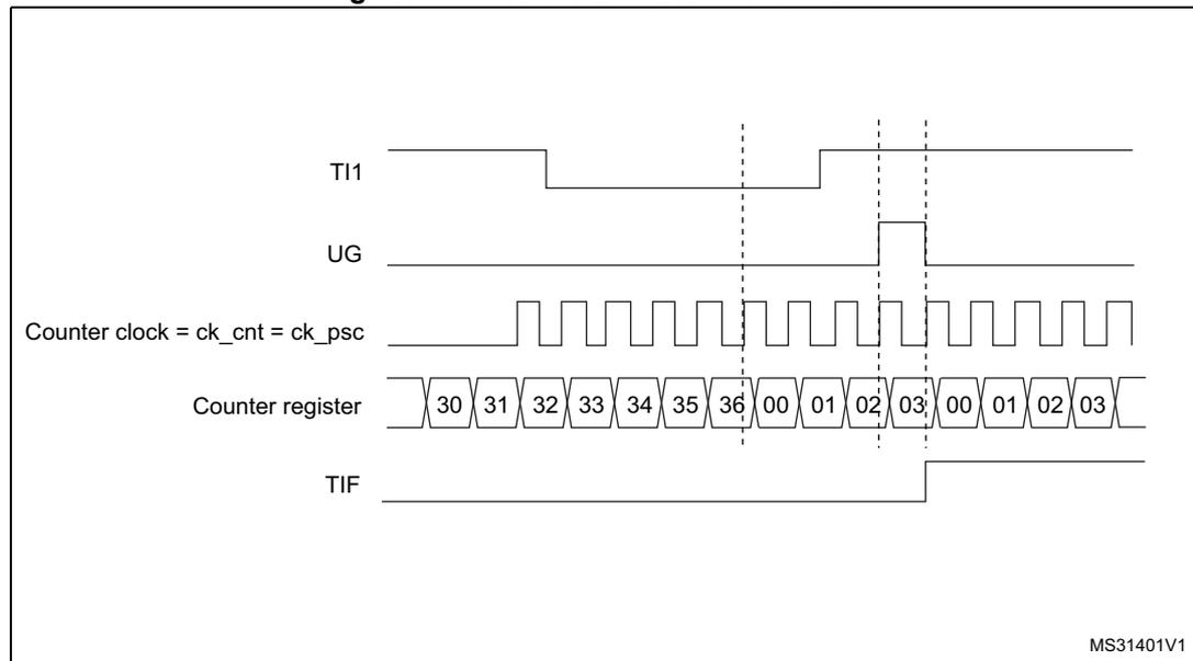 Timing diagram for Figure 177. Control circuit in reset mode. The diagram shows five horizontal lines representing signals over time. 1. TI1: A signal that is initially high, then goes low, and then has a rising edge. 2. UG: A signal that is initially low, then goes high at the rising edge of TI1, and then goes low again. 3. Counter clock = ck_cnt = ck_psc: A periodic square wave signal. 4. Counter register: A sequence of values: 30, 31, 32, 33, 34, 35, 36, 00, 01, 02, 03, 00, 01, 02, 03. The values 00, 01, 02, 03 are shown after the rising edge of TI1. 5. TIF: A signal that is initially low, then goes high at the rising edge of TI1, and then goes low again. Vertical dashed lines indicate the timing of the rising edge of TI1 and the subsequent changes in the other signals. The MS31401V1 identifier is in the bottom right corner.