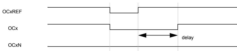 Timing diagram for Figure 86 showing deadtime waveforms where the delay is greater than the negative pulse. The diagram shows three waveforms: OCxREF, OCx, and OCxN. OCxREF is a reference signal. OCx and OCxN are complementary outputs. Deadtime is indicated by a double-headed arrow labeled 'delay' between the transitions of OCx and OCxN.